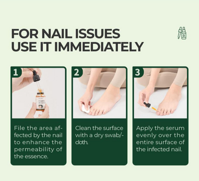 Nail Repair Magic Drops Multi Purpose Nail Repair Lotion for Discolored and Damaged Nails