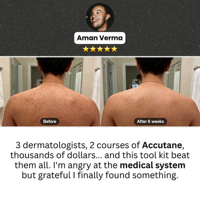 THE CLEAR FORTRESS™ - 3-Phase Folliculitis Defense System