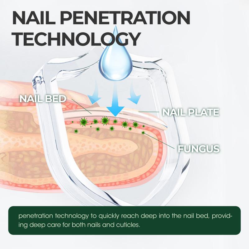 Nail Repair Magic Drops Multi Purpose Nail Repair Lotion for Discolored and Damaged Nails