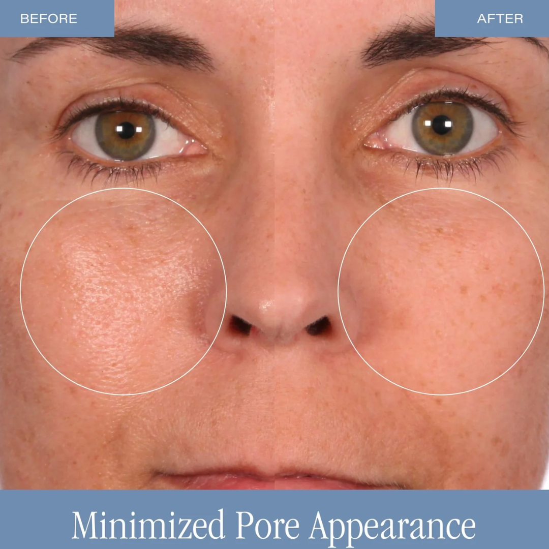 Microglow | 2-Minute Microderm Glow Polish