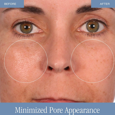 Microglow | 2-Minute Microderm Glow Polish