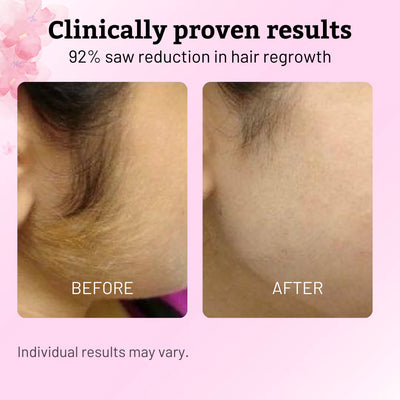Natural Hair Reduction Oil | Slows Regrowth with Cyperus Root Extract